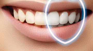 جرمگیری دندان و بلیچینگ چه تفاوتی دارد؟