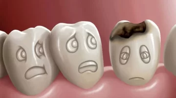 فیلم انیمیشن فرآیند ترمیم پوسیدگی دندان