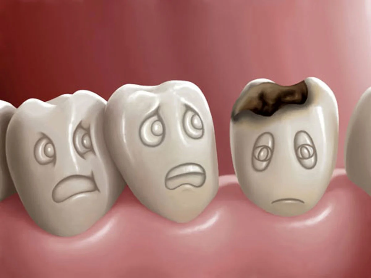 فیلم انیمیشن فرآیند ترمیم پوسیدگی دندان